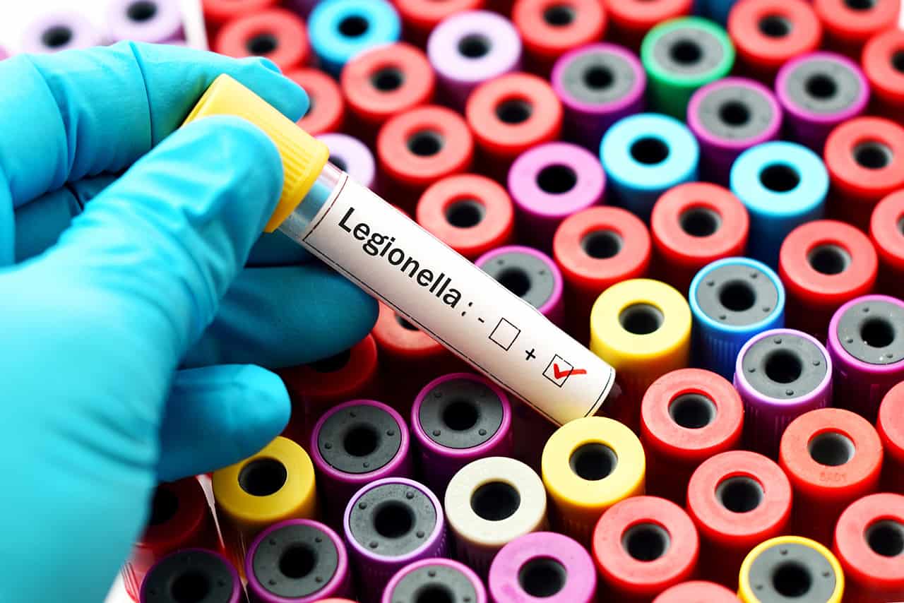 Legionella warning